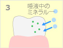3.初期のむし歯部分に唾液中の成分（リン、カルシウムなど）が取り込まれ、フッ素が再石灰化を促進するイメージイラスト