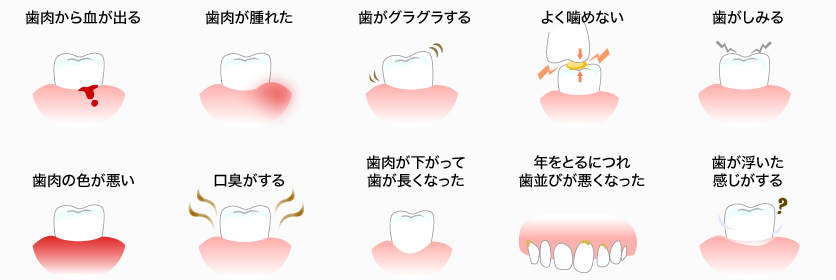 下記のような症状がみられる場合は、歯周病の可能性がありますの、